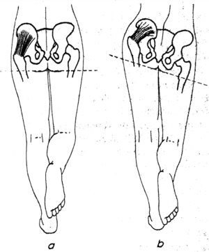láb ízületi gyulladás és kezelés